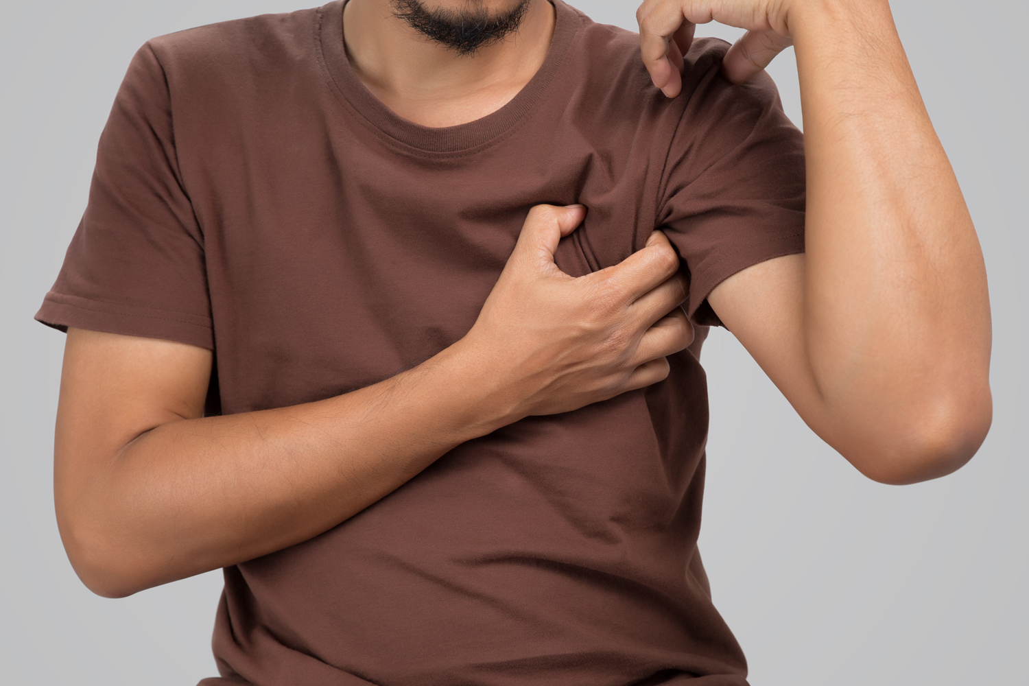 Gynecomastia Grades
