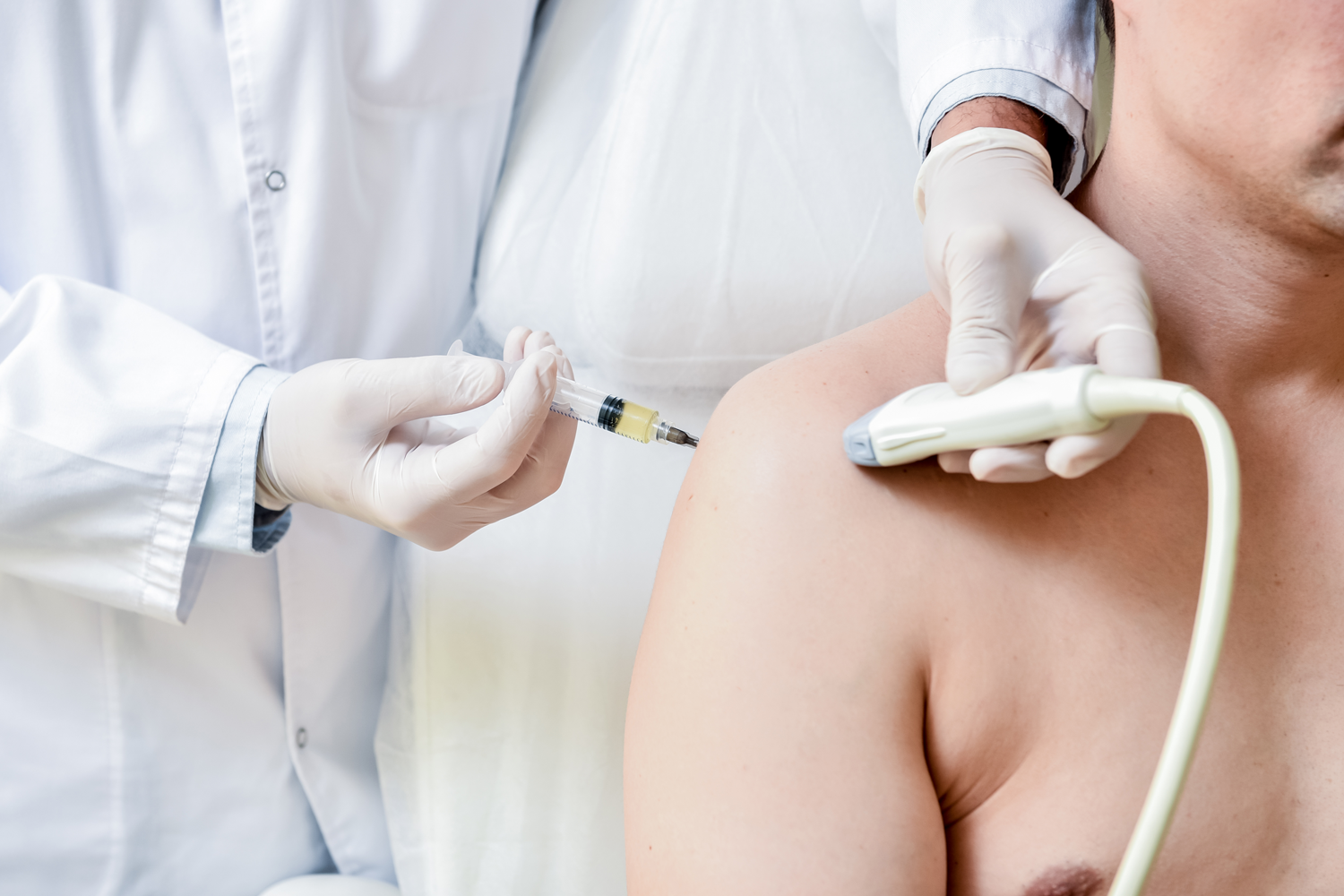 Gynecomastia